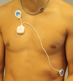 Bodygard HRV recorder met 2 electroden